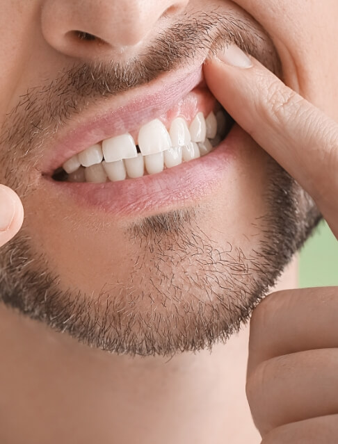 Close up of man pointing to his gums