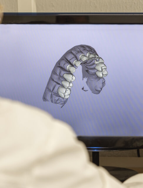 3 D model of a row of teeth on a computer screen