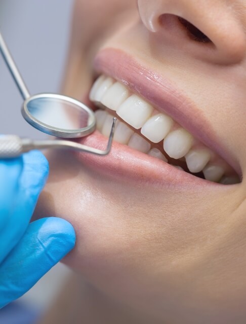 Close up of smile next to dental mirror