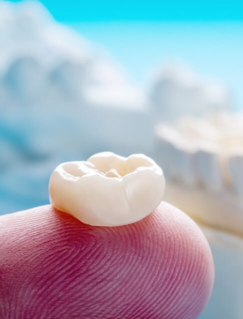 Dental crown resting on a finger