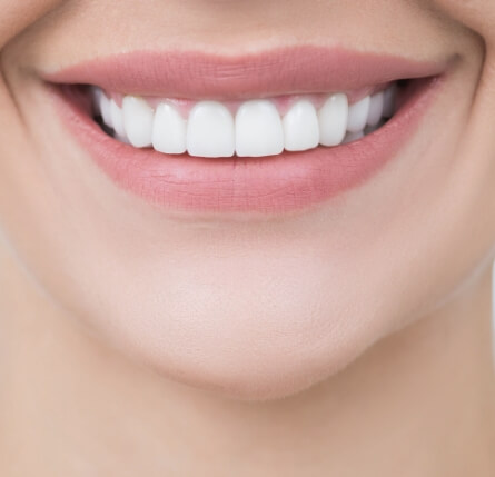 Close up of smile just showing the upper row of teeth