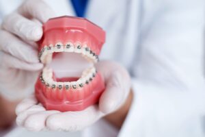 White-gloved hands holding model teeth with silver braces